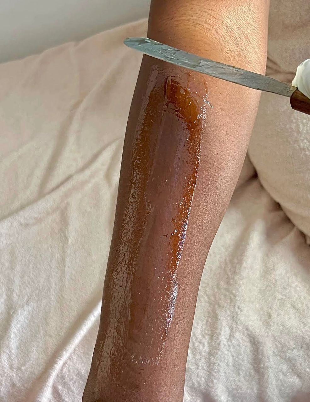 Epilation